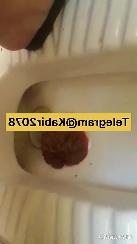 imgKqyNzwwu