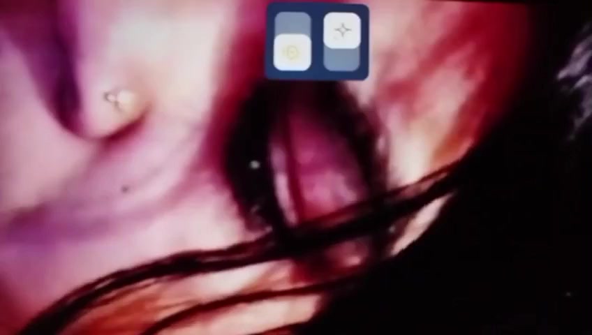 Frame 10