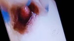 VID video