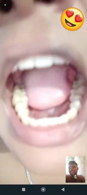 IMG3