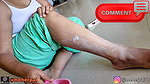 How To Remove Unwanted Hairs Permanently DIY HOME MADE REMEDY
