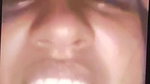 25 vid 3