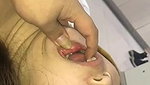 v