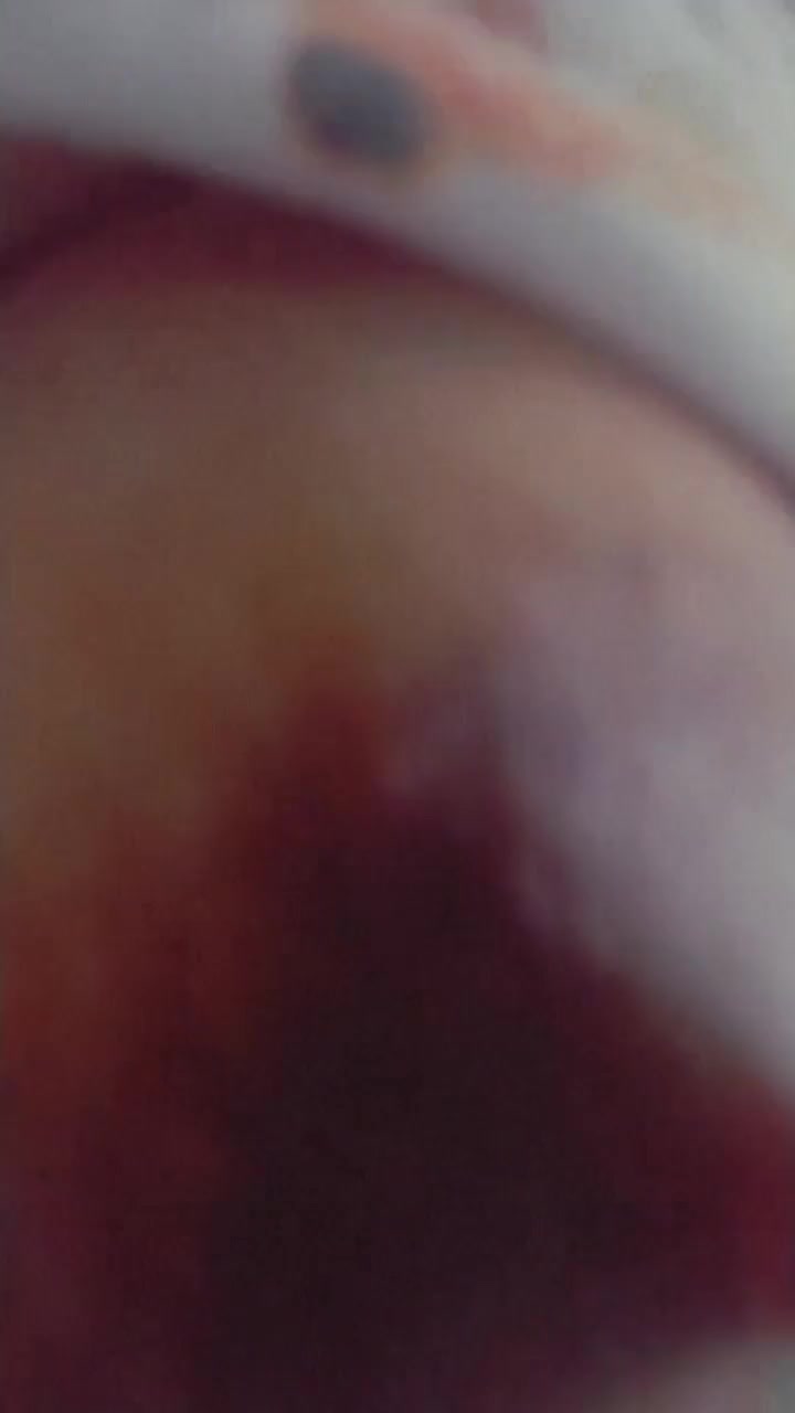 Frame 10
