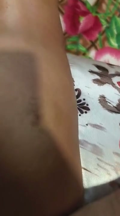 Frame 2