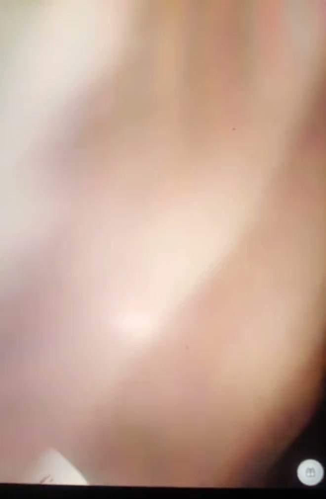 Frame 1