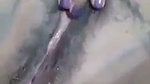 1000191593