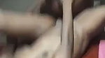 1000191572