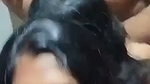 1000191572