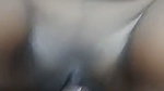 1000191572