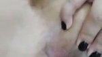 1003138132