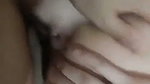 1000218556