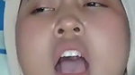1000218551