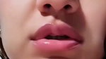 1000511795