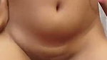 1000681132