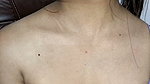 1001084681
