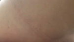 anal masturbation