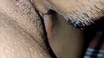 1000056494