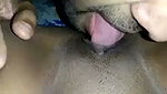 1000056474