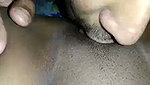 1000056474
