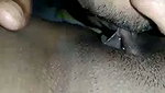 1000056474