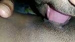 1000056474