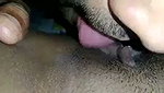 1000056474