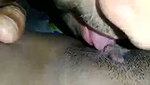 1000056474
