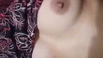 1000056491