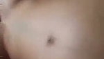 1000056491