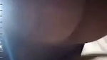 1000056491