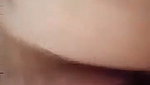 1000056491