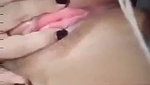 1000056491