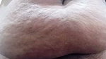 1000040606