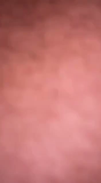 Frame 2