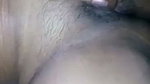 1000176995
