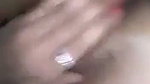 1000176987