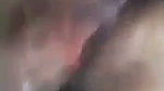1000176987