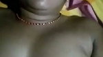 1000177624
