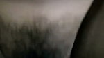 1000177624