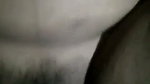 1000177624