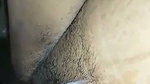1000177623