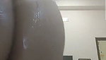 1000268861