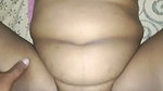 1000761628