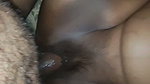 1000761628