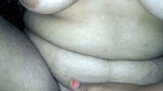 1000618471