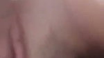 1000157632