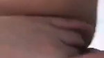 1000157632
