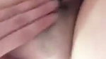 1000157632