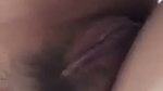 1000157632